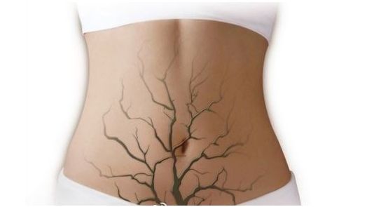 HRA健康风险评估 HRA健康风险评估