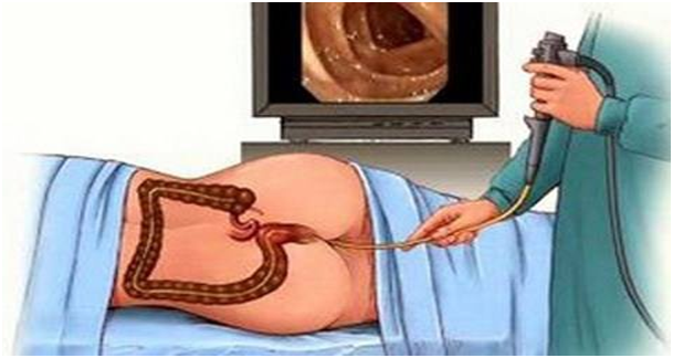 HRA健康风险评估 HRA健康风险评估