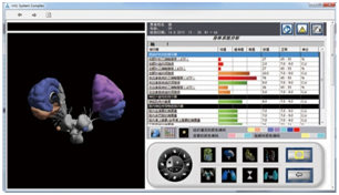 ERA细胞断层扫描